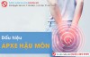 Dấu hiệu apxe hậu môn và cách điều trị apxe hậu môn